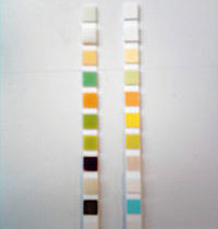 200px-comp-urine-test-strip